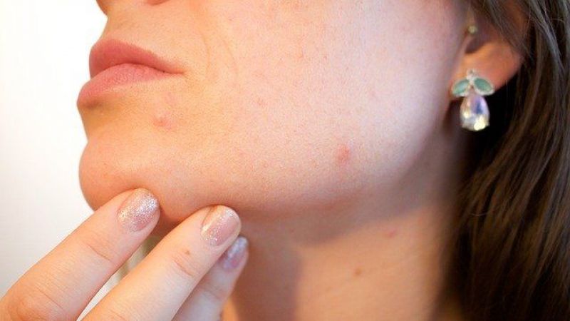 Thiocilline Krem Fiyatı Nedir, Ne İşe Yarar